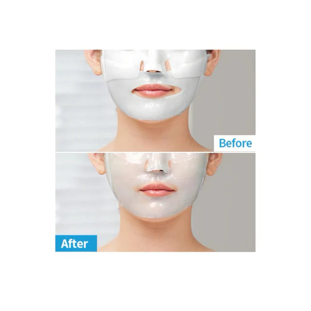 MediAnswer Pore Collagen Clear Pad - 83% Collagen Hydrogel Mask for Pore Tightening & Sebum Control