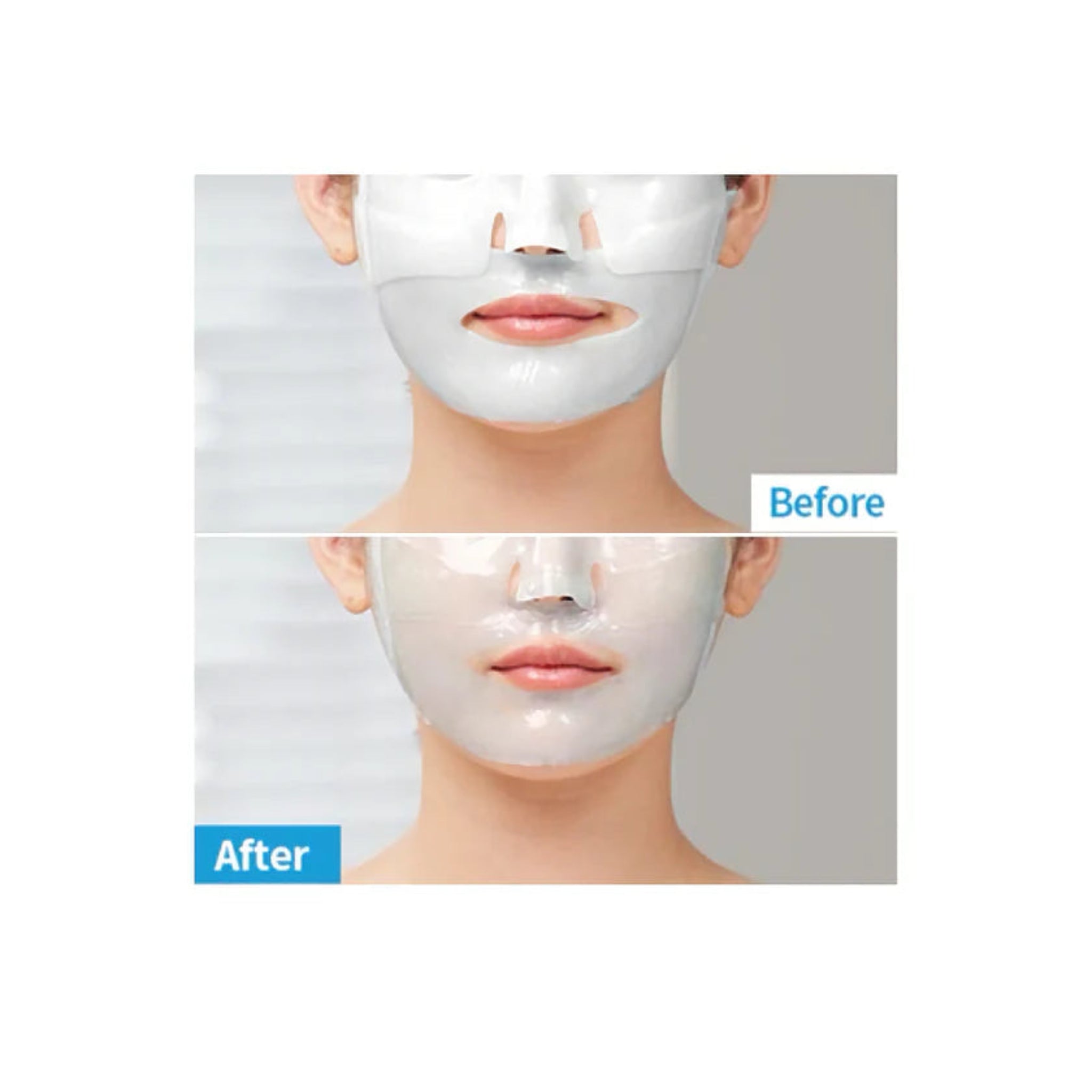 MediAnswer Pore Collagen Clear Pad - 83% Collagen Hydrogel Mask for Pore Tightening & Sebum Control