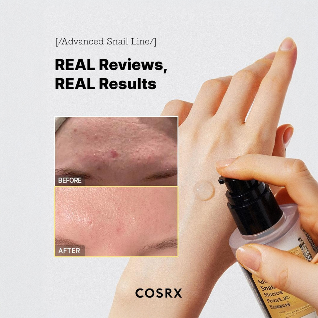 COSRX Advanced Snail 96 Mucin Power Essence 30ml - Korean Hydrating Face Serum for Acne Scars