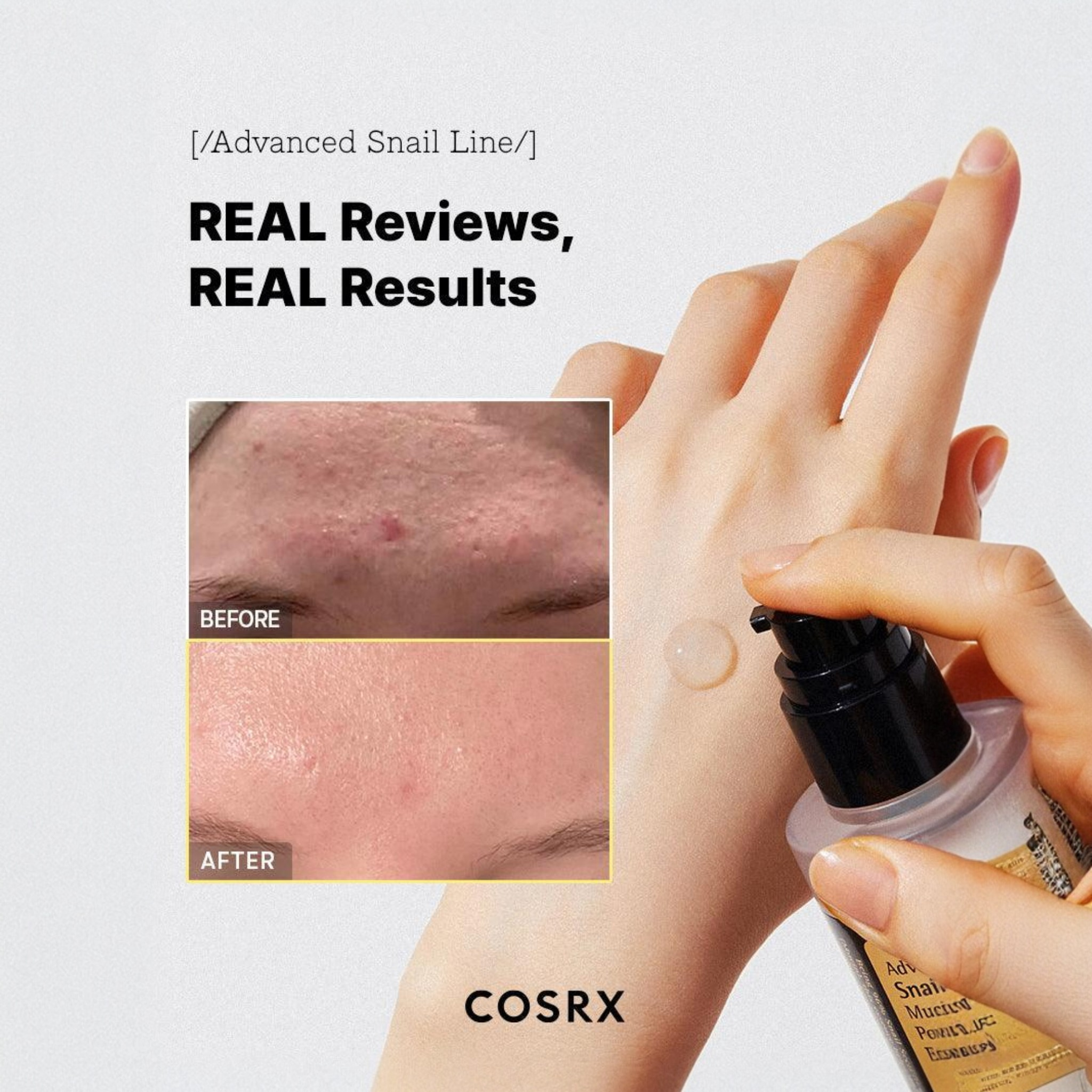 COSRX Advanced Snail 96 Mucin Power Essence 30ml - Korean Hydrating Face Serum for Acne Scars